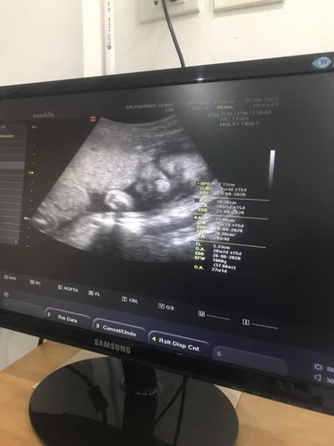 28week