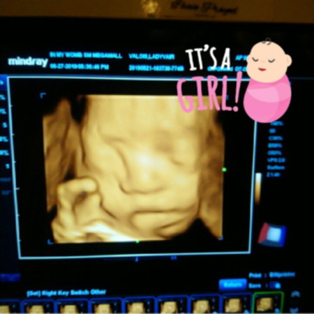 Congenital Scan Review