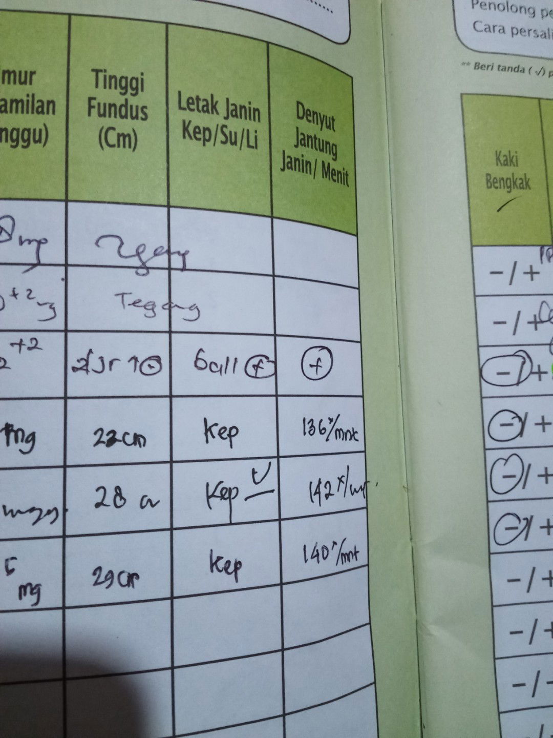 Bunda maaf bener ga nih klo letak kepalanya udah dibawah,soalnya AQ baru pertama punya anak jadi AQ kwatir