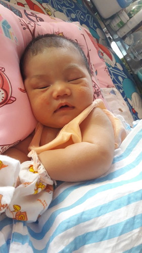 ผื่นขึ้นหน้าลูกทำไงดีค่ะแม่ๆ