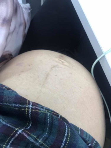 ลูกดิ้น