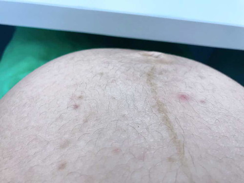 ลูกโก่งตัว