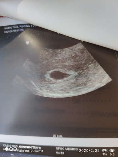5th week and 5th day