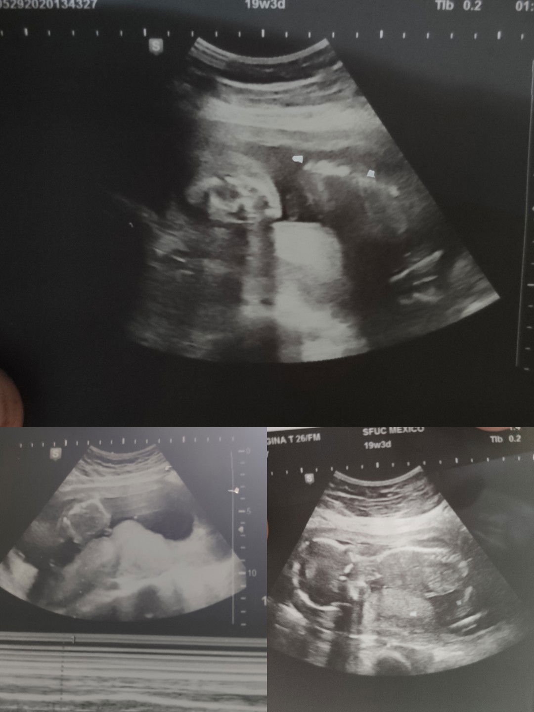 may gender nabang makikita dito?