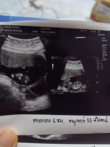 เหมือนจะได้ลูกชาย