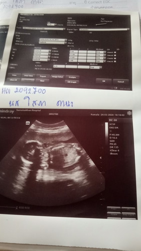 แม่ๆช่วยดูไห้ทีแบบนี้น้องเป็นญ.รึว่าช.ค่ะมาทายกันค่ะ