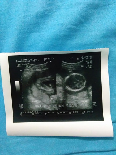 เพศลูก