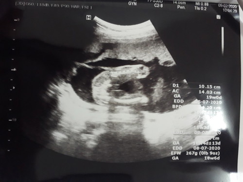 อันนี้ชายหรือหญิง