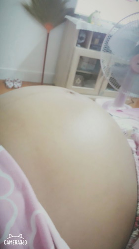 36week 2 d