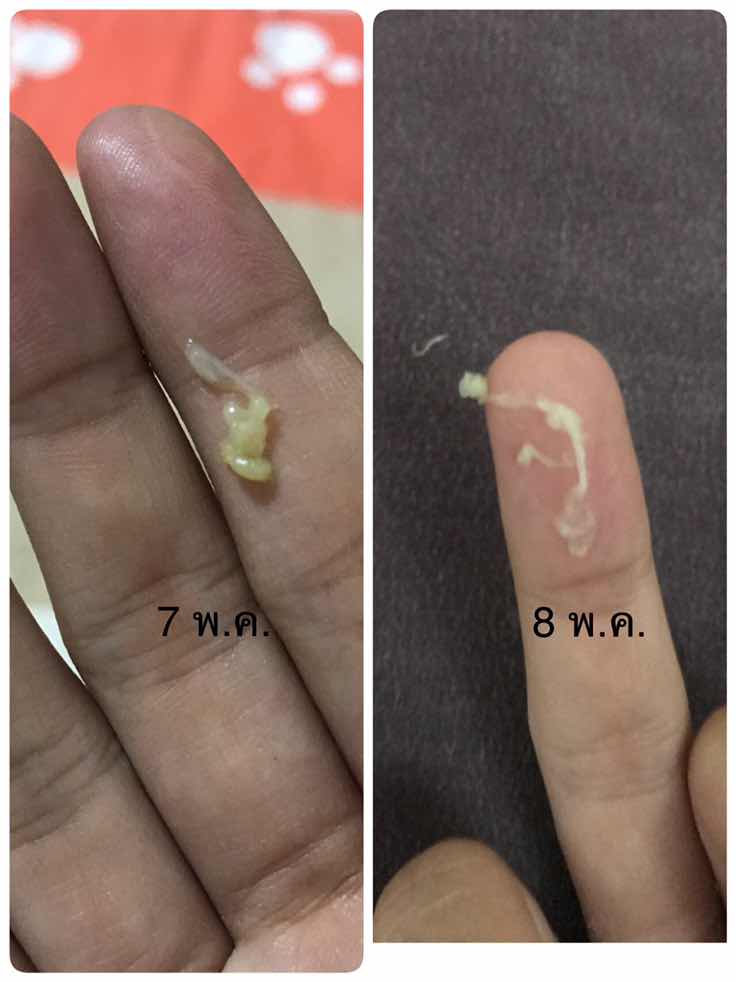 อันนี้คือมูกใสหรือตกขาวคะ