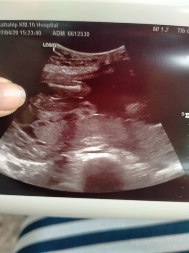 เพศลูก