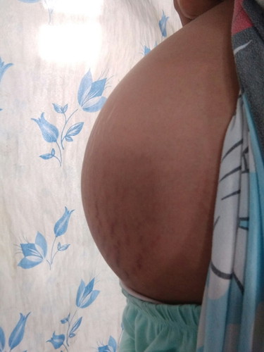 maliit mag buntis