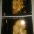 alhamdulillah baby boy anx qu yg k'2 jd punya anx sepasang deh