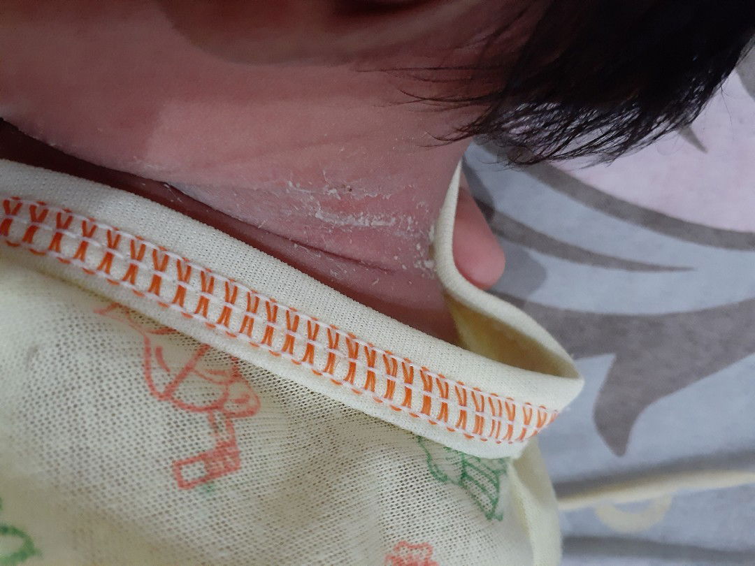 kok kayak ngelupas ??