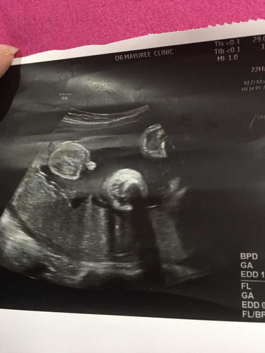 กรกฎาคม