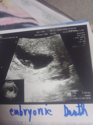 เสียแล้ว