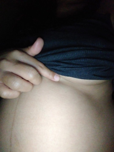 Hi ! ? sumasakit baba ng right side ng dede.