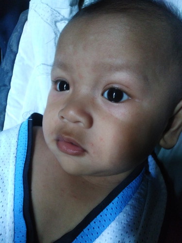 Face