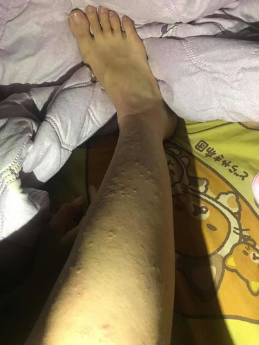 เคลียมาก