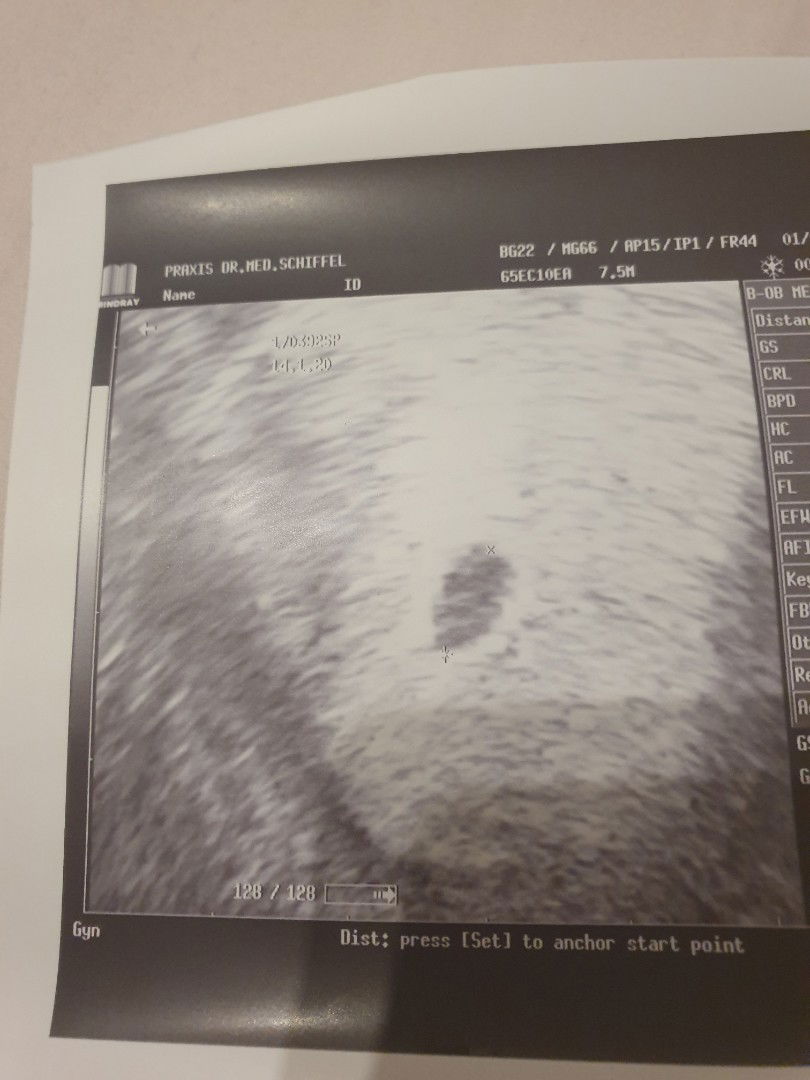 I had UTZ is this normal?