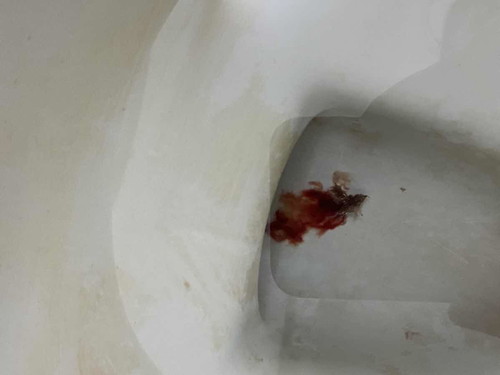 หมอตรวจภายในปากมดลูกเปิด1เซ็นเลยให้กลับบ้าน