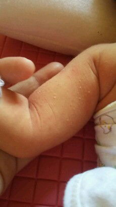 kringet buncet bayi baru lahir