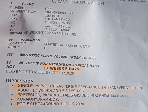 ultrasound result