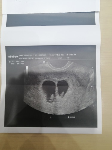 This Apps Is Not Availablefor Twin Pregnancy?