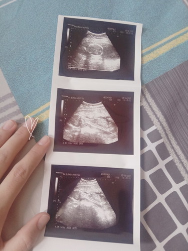 มีคนบอกว่าซาวด์บ่อยอันตรายต่อน้องหรอคะ ?