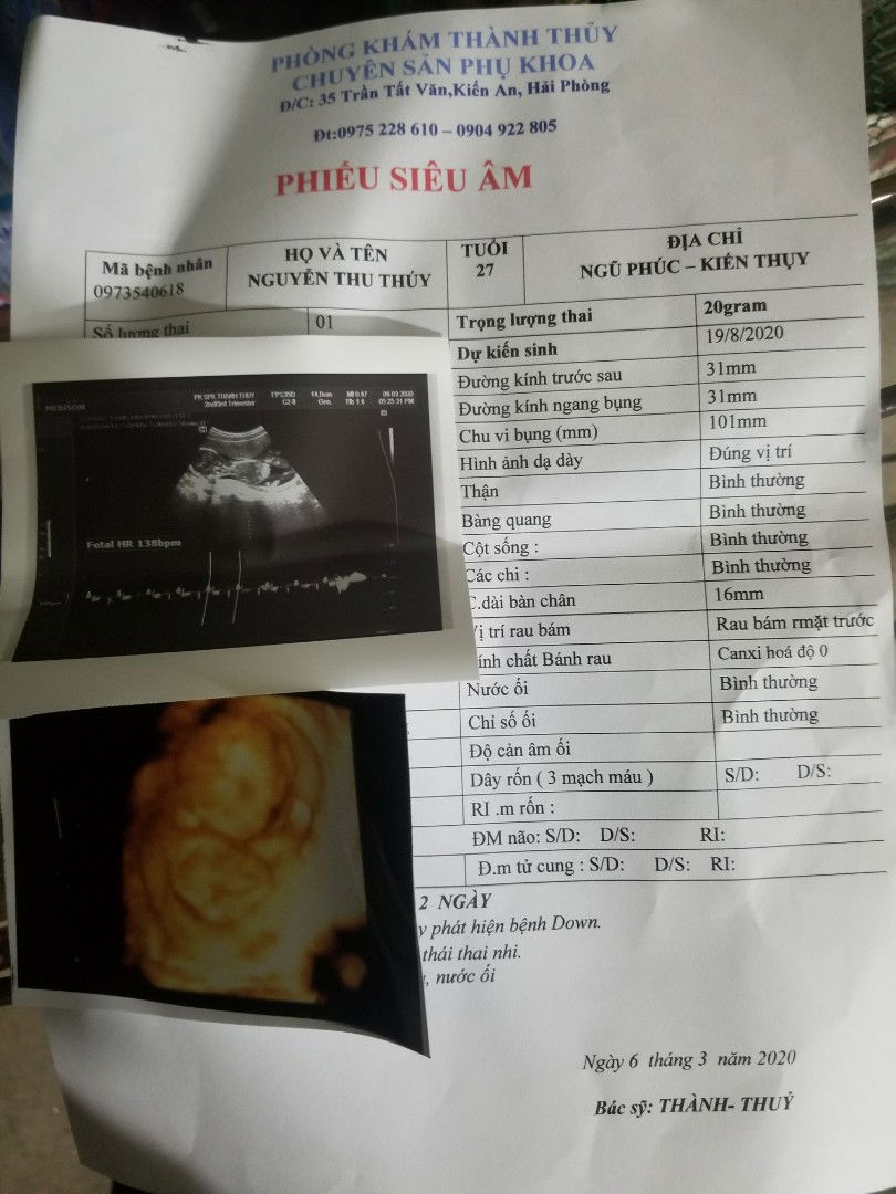 các m giúp e với