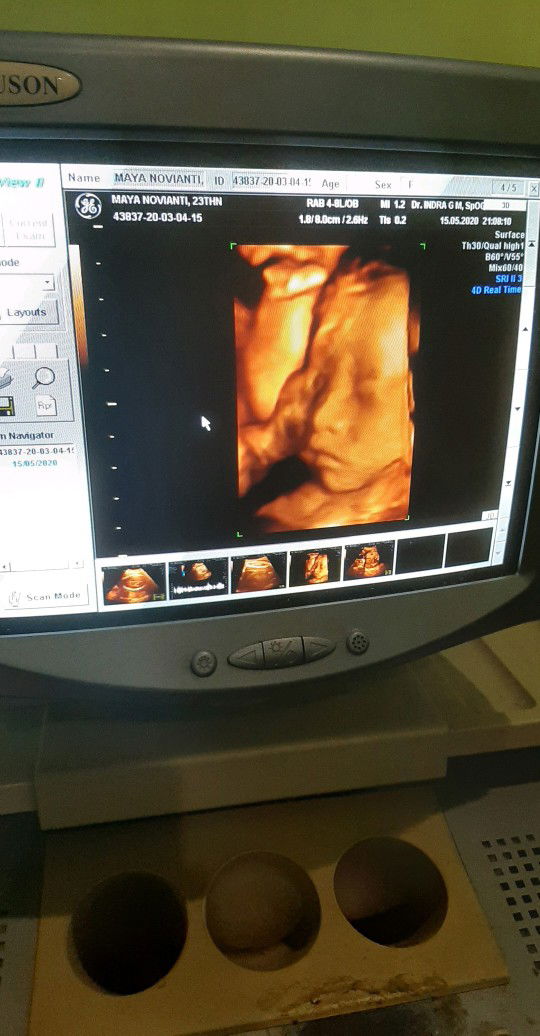 gak basar nunggu hpl 🤗