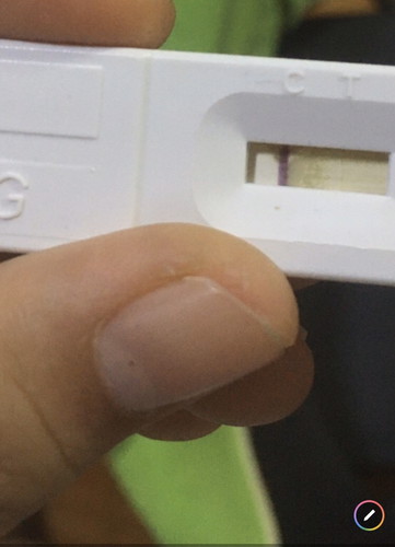 ตรวจฉี่แล้วขึ้นขีดจางๆสีขาวใครเคยเป็นบ้างคะ