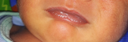 lips ni baby