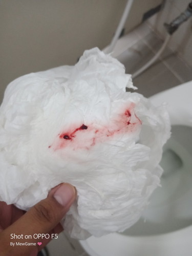 มีหริ่มเลือดออก