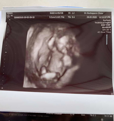 14+2w