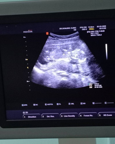 น้องหนีบขา