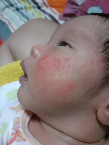 แบบนี้เป็นอะไรค่ะ