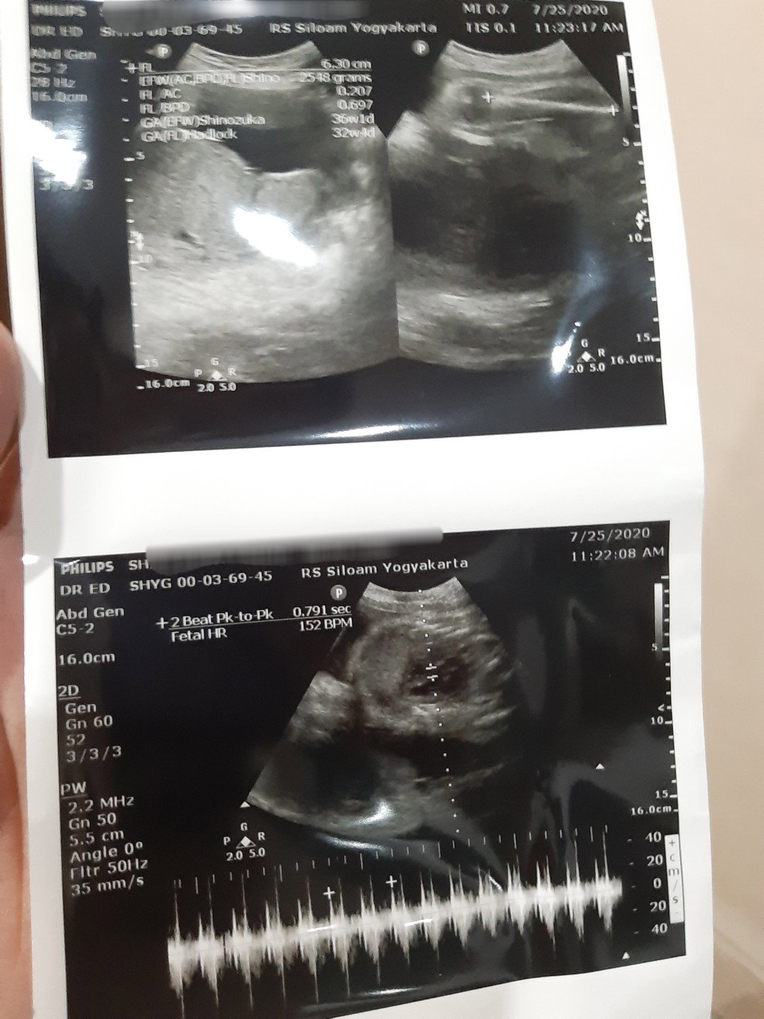 Mashaallah lucunya si adek