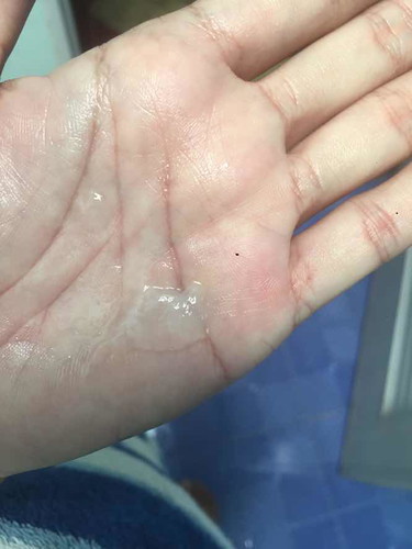 แบบนี้ใช้มูกใสมั้ยค่ะ???