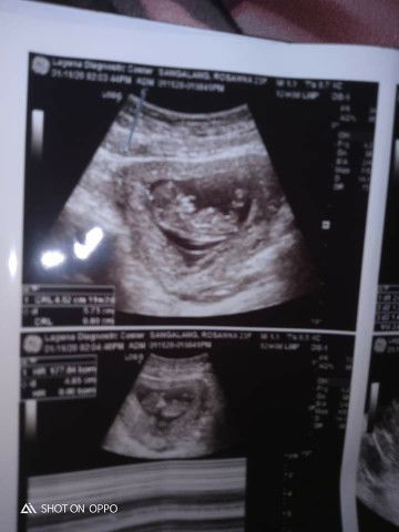 Anna Ni Lino profile icon