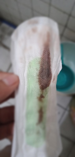 regular Po ako mag means Kya NG tataka ako 1 day lng ako nagkaroon NG means. Dec 8-14 last means ko Dec 30 nag do Po kmi NG partner ko January 6 nagkaroon Po ako 1 day 7,8,9 and 10 patak n lng PO lumalabas skn .may possibility Po kayang buntis ako???