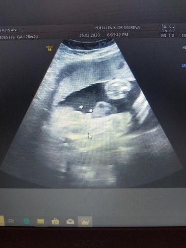 boy or girl?