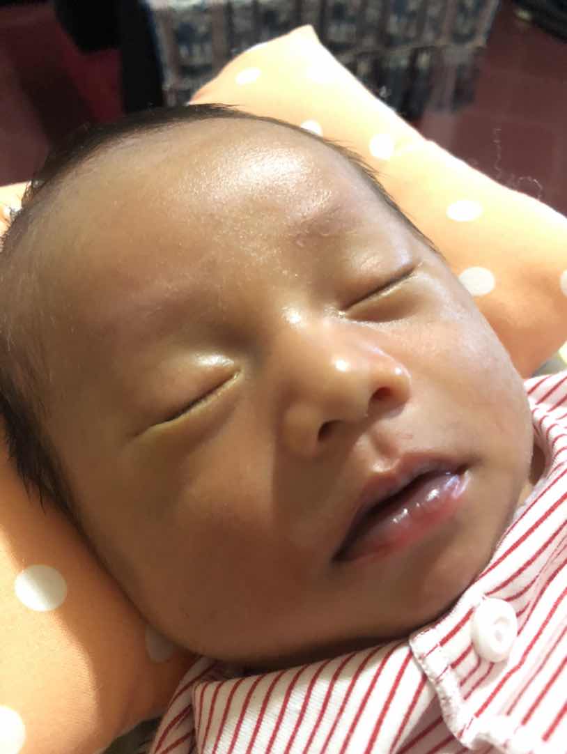 Bibir bayi menghitam