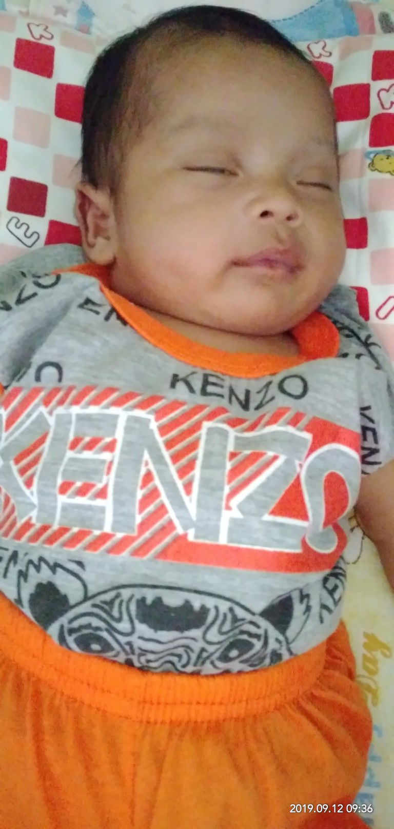 WASAPADAI GUMOH BERLEBIH PADA ANAK