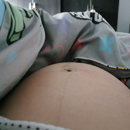 32 Week แล้ว