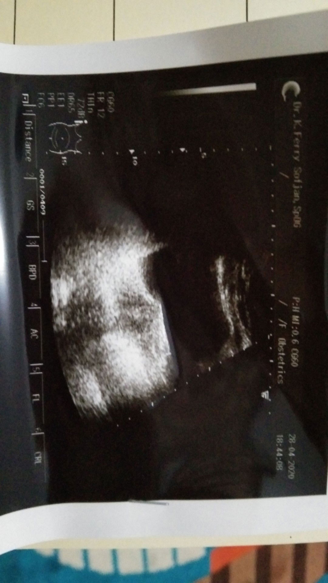 usg pertama saat tau positif (lagi)