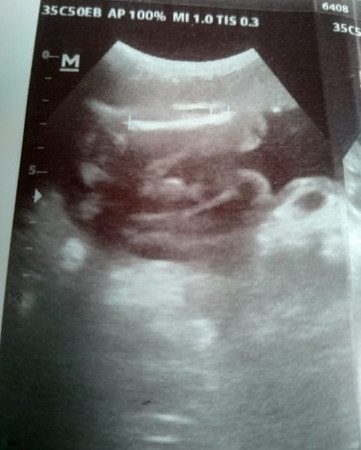 Scan gender
