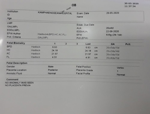 ดูใบซาวด์