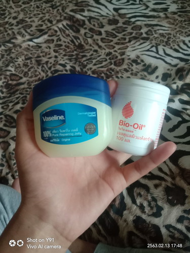 กันท้องลาย