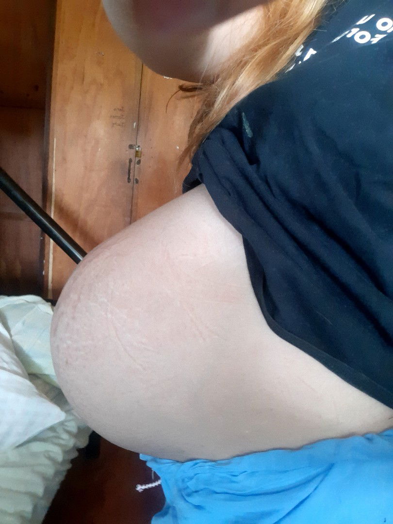 june 22 due ko no sign of labor